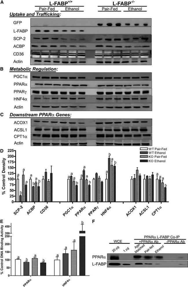 PPAR alpha Antibody in Western Blot, Immunoprecipitation (WB, IP)