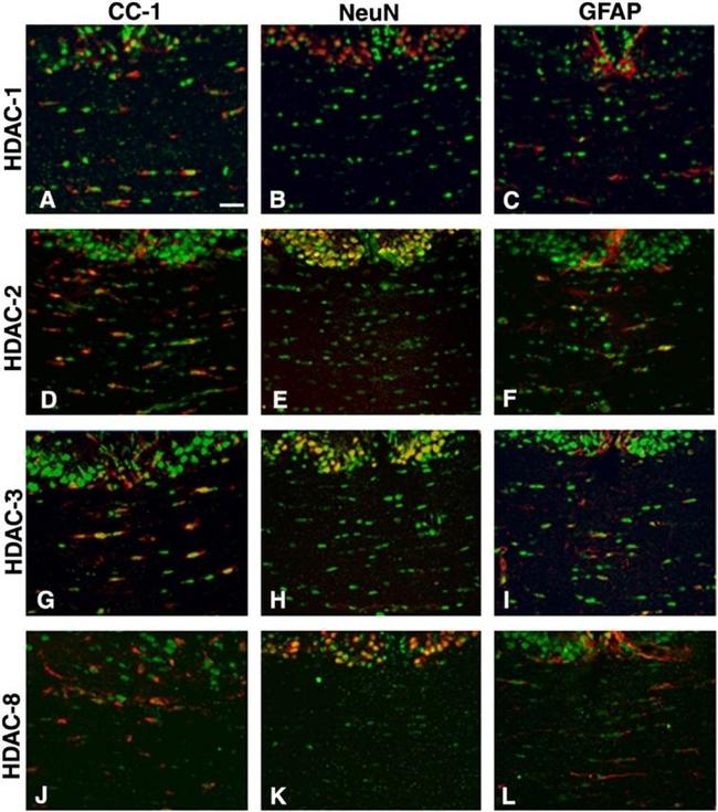 HDAC1 Antibody in Immunohistochemistry (IHC)