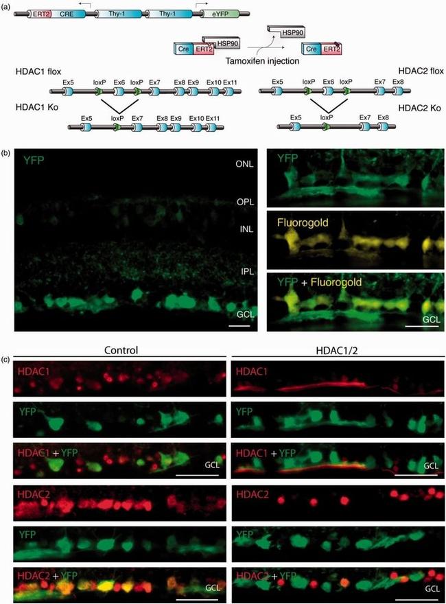 HDAC1 Antibody in Immunohistochemistry (Paraffin) (IHC (P))