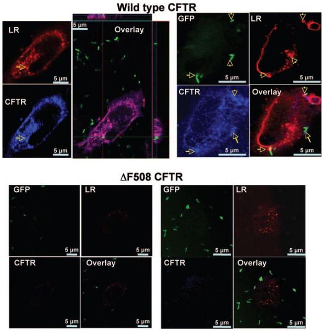 CFTR Antibody in Immunocytochemistry (ICC/IF)