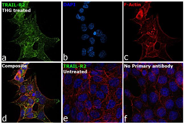 TRAIL-R2 (DR5) Antibody