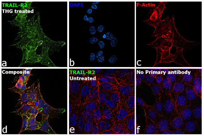 TRAIL-R2 (DR5) Antibody in Immunocytochemistry (ICC/IF)