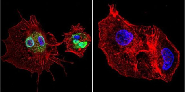 Cyclophilin 40 Antibody in Immunocytochemistry (ICC/IF)