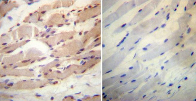 Cyclophilin 40 Antibody in Immunohistochemistry (Paraffin) (IHC (P))