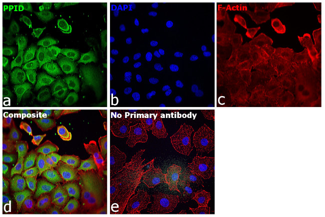 Cyclophilin 40 Antibody in Immunocytochemistry (ICC/IF)