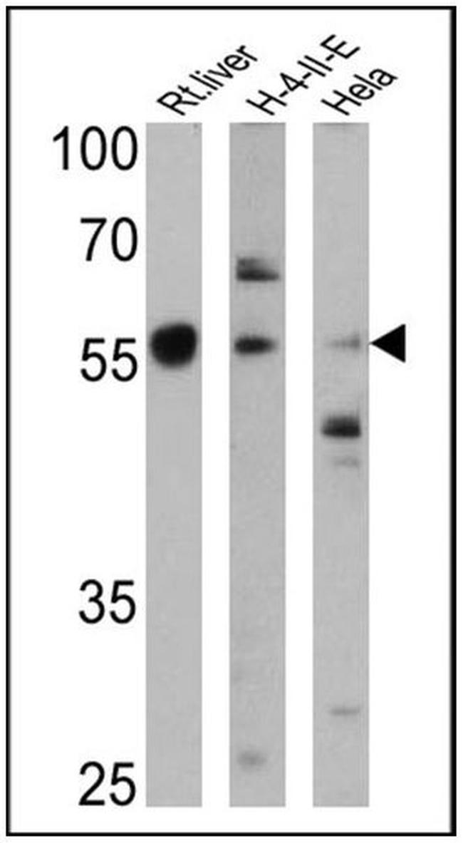 Cyp4a10 Antibody in Western Blot (WB)