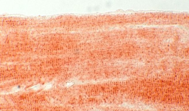 SMPX Antibody in Immunohistochemistry (IHC)