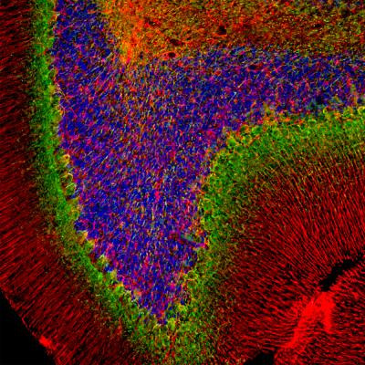 alpha Internexin Antibody in Immunohistochemistry (Paraffin) (IHC (P))