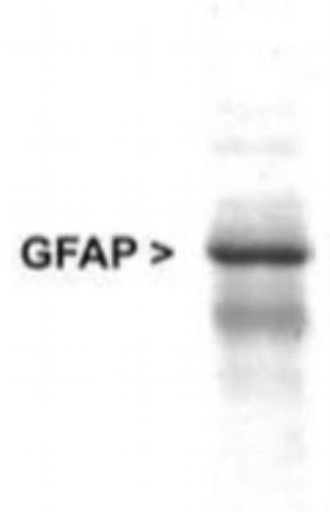 GFAP Antibody in Western Blot (WB)