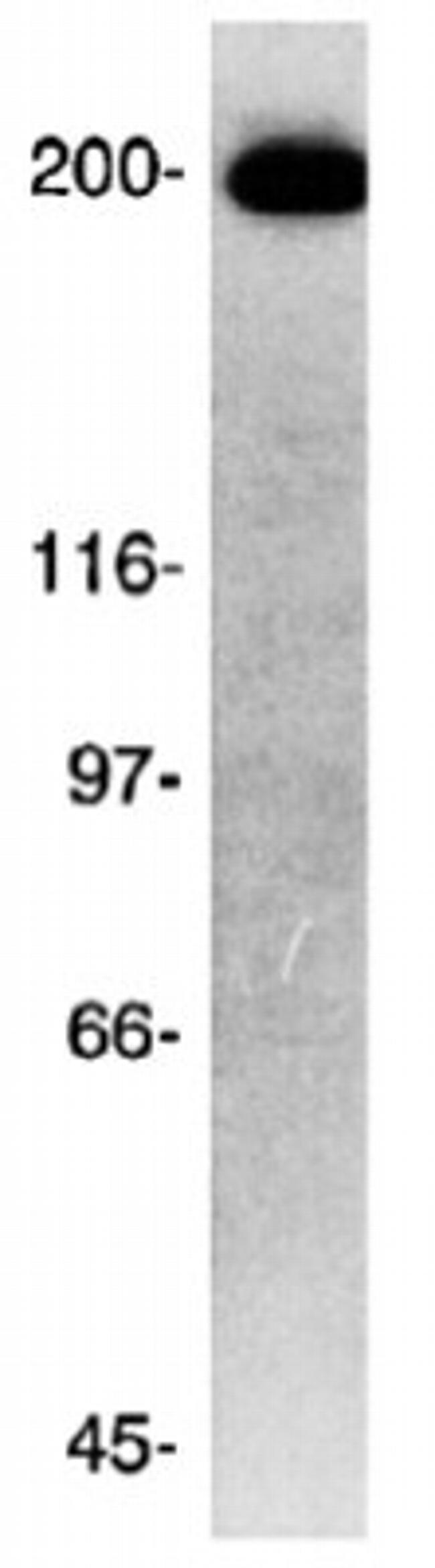 CKAP5 Antibody in Western Blot (WB)