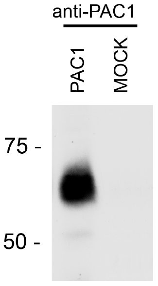 PACAP Receptor Polyclonal Antibody PA3 213