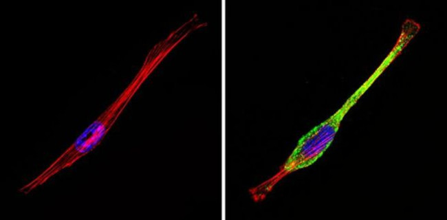 IGF2R Antibody in Immunocytochemistry (ICC/IF)