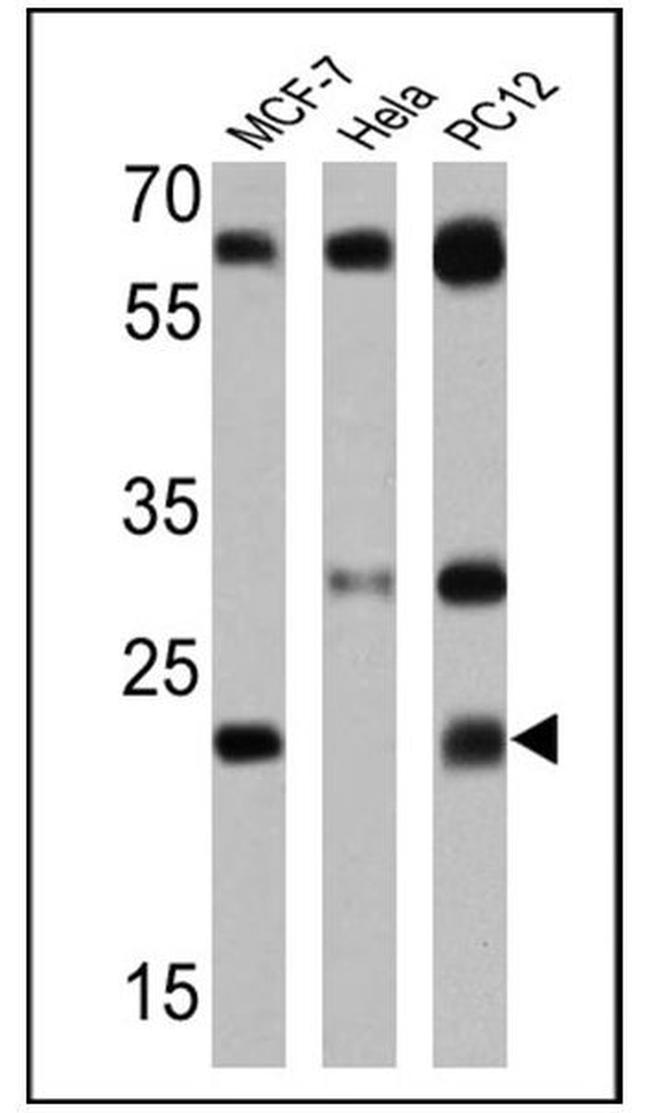 RAB5 Antibody in Western Blot (WB)