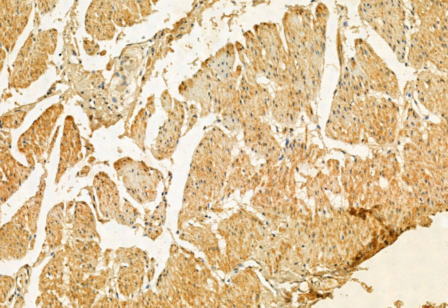 Kindlin 2 Antibody in Immunohistochemistry (Paraffin) (IHC (P))