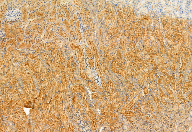 Kindlin 2 Antibody in Immunohistochemistry (Paraffin) (IHC (P))