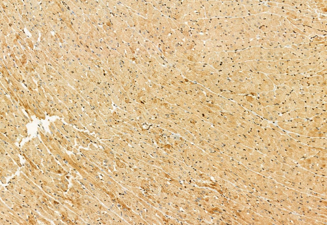 OXCT1 Antibody in Immunohistochemistry (Paraffin) (IHC (P))