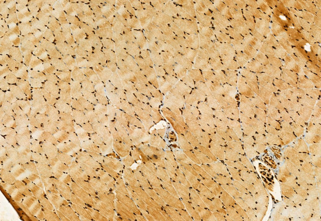 OXCT1 Antibody in Immunohistochemistry (Paraffin) (IHC (P))