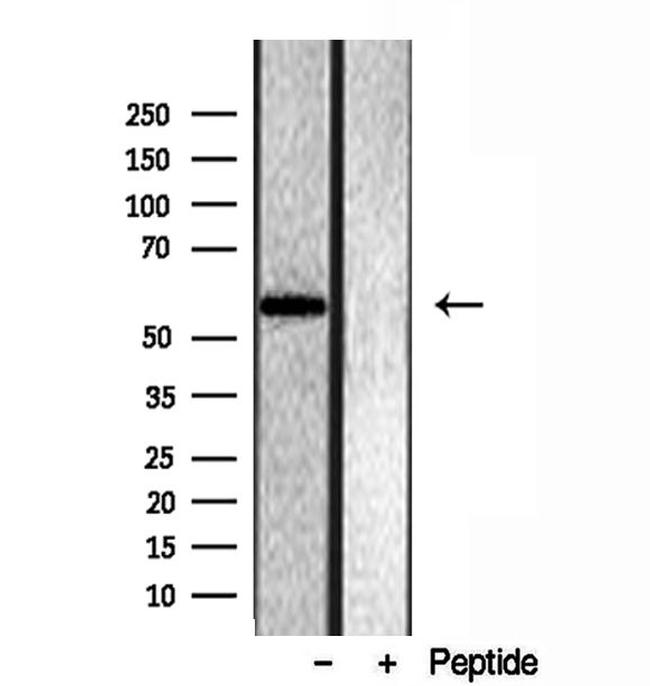 OXCT1 Antibody in Western Blot (WB)