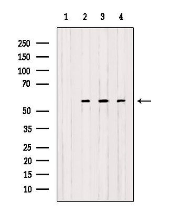 OXCT1 Antibody in Western Blot (WB)