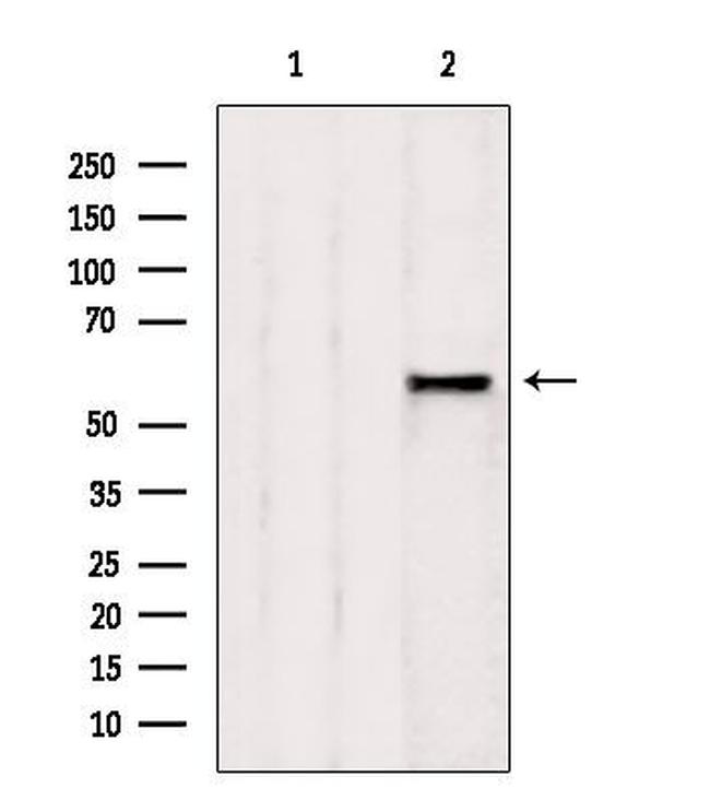 AdoHcyase 2 Antibody in Western Blot (WB)