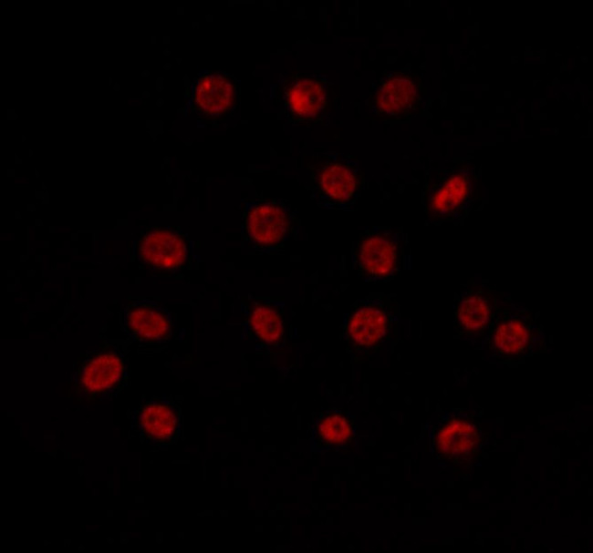 SPOP Antibody in Immunocytochemistry (ICC/IF)