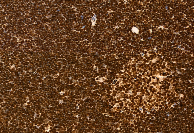 SPOP Antibody in Immunohistochemistry (Paraffin) (IHC (P))