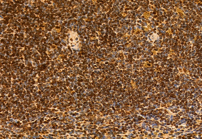 SPOP Antibody in Immunohistochemistry (Paraffin) (IHC (P))