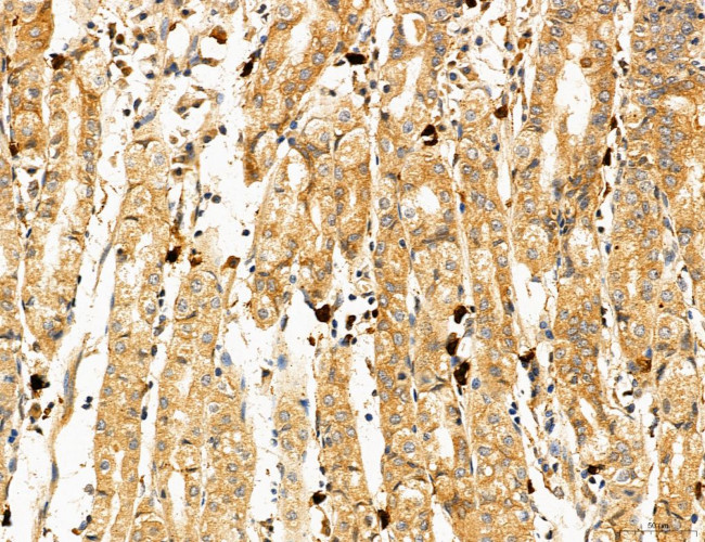 PYGL Antibody in Immunohistochemistry (Paraffin) (IHC (P))