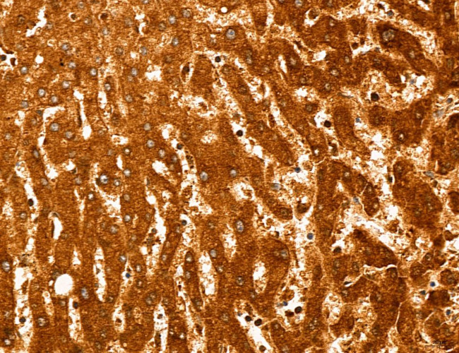 PYGL Antibody in Immunohistochemistry (Paraffin) (IHC (P))