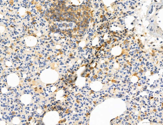 PYGL Antibody in Immunohistochemistry (Paraffin) (IHC (P))