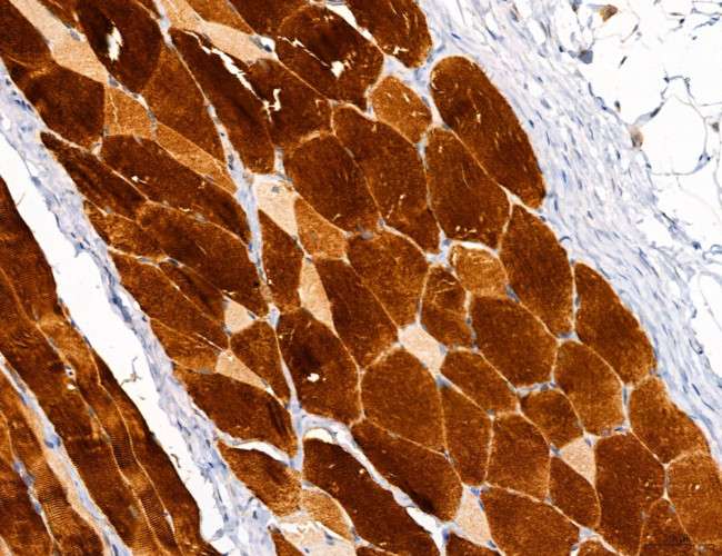 PYGL Antibody in Immunohistochemistry (Paraffin) (IHC (P))