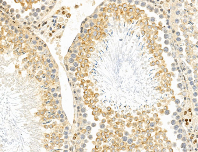 PYGL Antibody in Immunohistochemistry (Paraffin) (IHC (P))