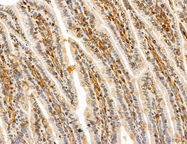 PYGL Antibody in Immunohistochemistry (Paraffin) (IHC (P))