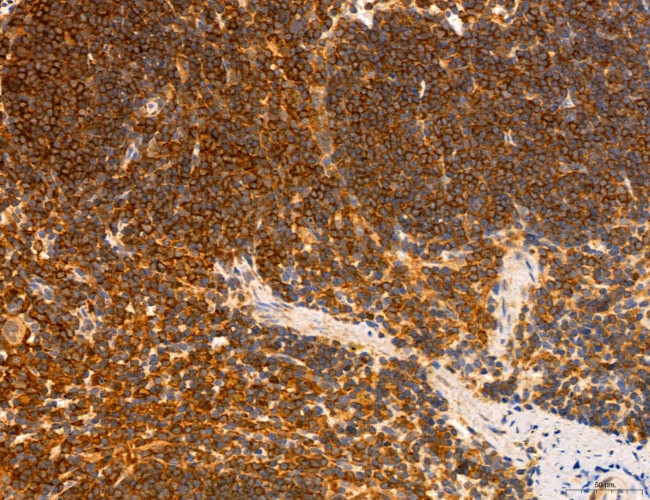 PYGL Antibody in Immunohistochemistry (Paraffin) (IHC (P))