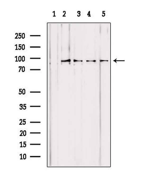 PYGL Antibody in Western Blot (WB)