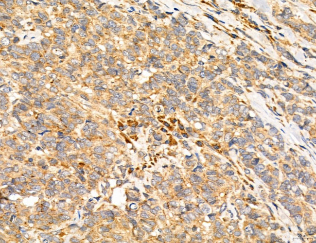 SULT1E1 Antibody in Immunohistochemistry (Paraffin) (IHC (P))