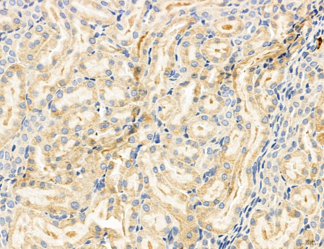 SULT1E1 Antibody in Immunohistochemistry (Paraffin) (IHC (P))