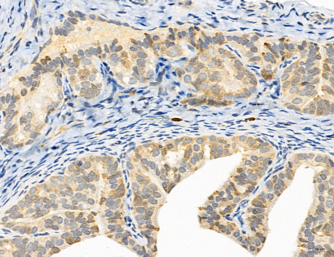 SULT1E1 Antibody in Immunohistochemistry (Paraffin) (IHC (P))