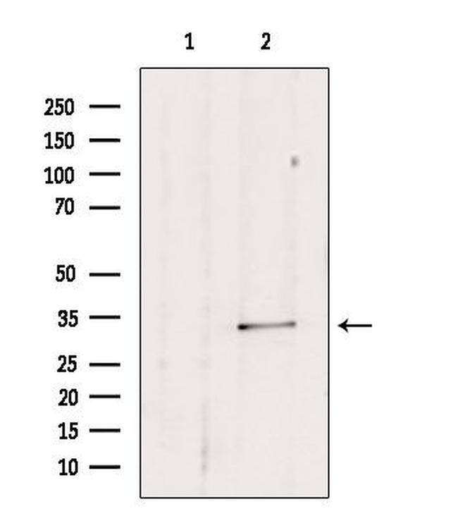 SULT1E1 Antibody in Western Blot (WB)