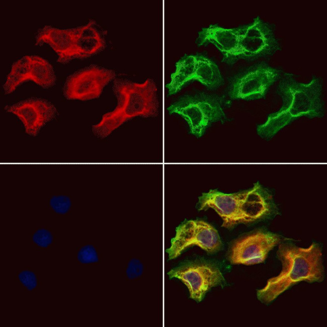 ZCCHC11 Antibody in Immunocytochemistry (ICC/IF)