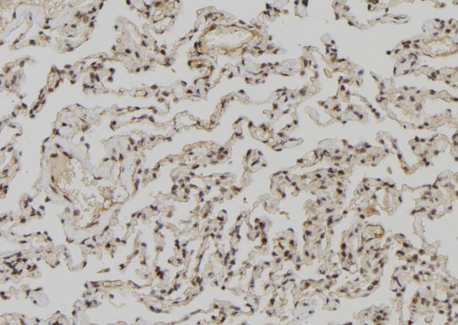 ZCCHC11 Antibody in Immunohistochemistry (Paraffin) (IHC (P))