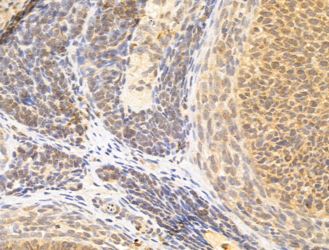 ZCCHC11 Antibody in Immunohistochemistry (Paraffin) (IHC (P))