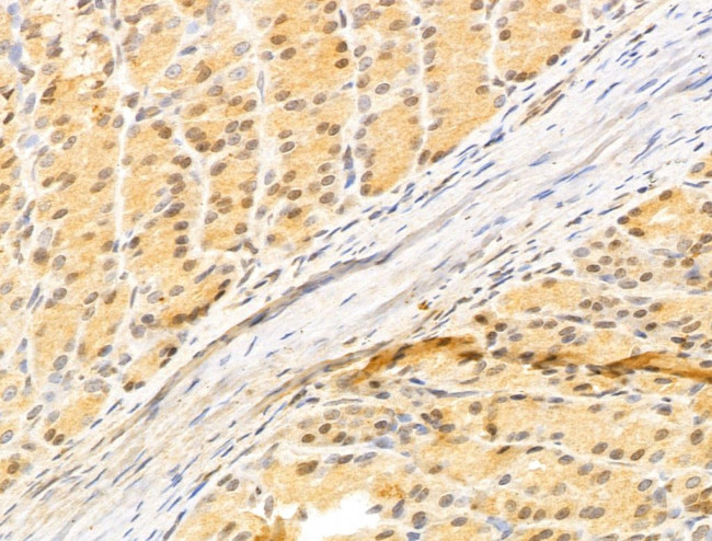 ZCCHC11 Antibody in Immunohistochemistry (Paraffin) (IHC (P))