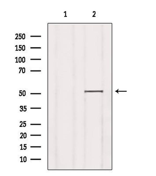SLC30A6 Antibody in Western Blot (WB)