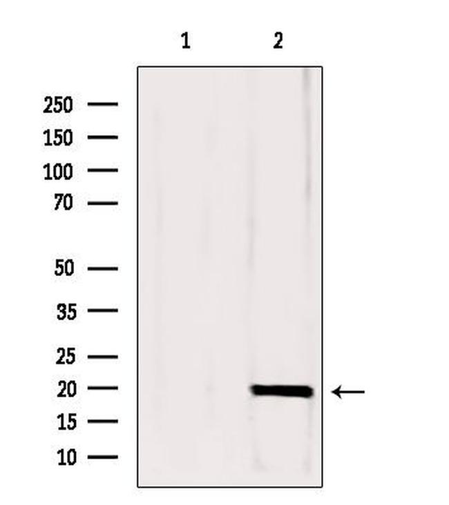 CPLX1 Antibody in Western Blot (WB)
