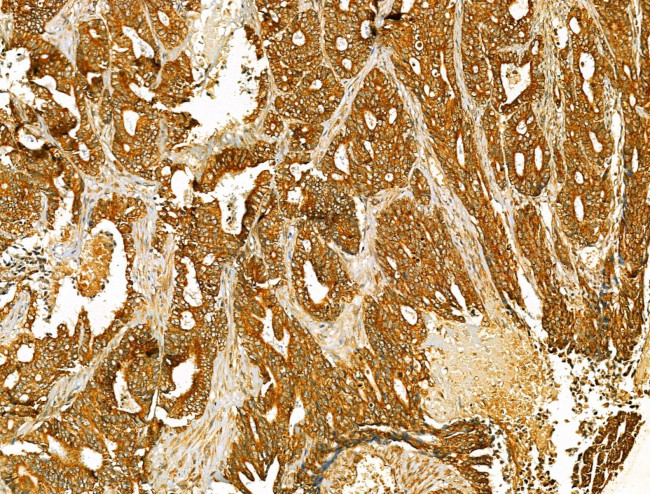 HRD1 Antibody in Immunohistochemistry (Paraffin) (IHC (P))