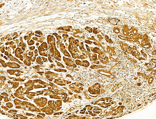 HRD1 Antibody in Immunohistochemistry (Paraffin) (IHC (P))