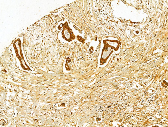 HRD1 Antibody in Immunohistochemistry (Paraffin) (IHC (P))