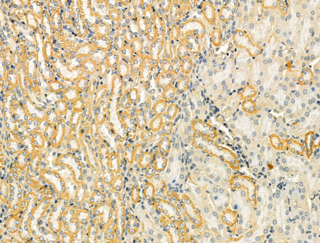 TOMM40 Antibody in Immunohistochemistry (Paraffin) (IHC (P))