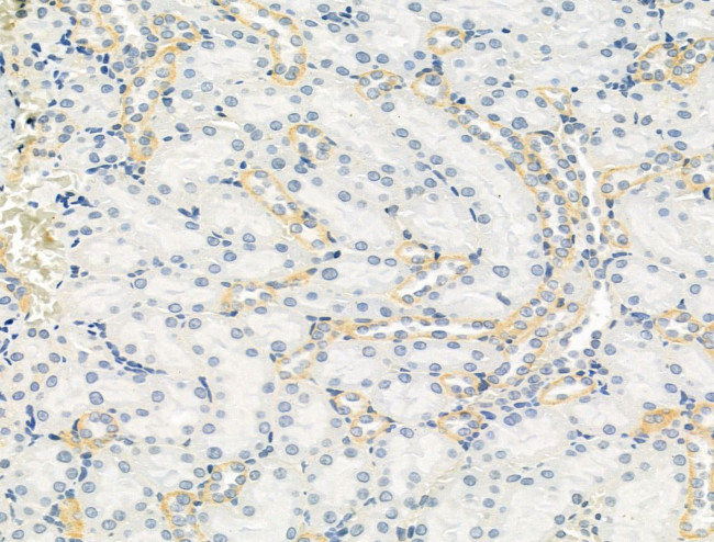 TOMM40 Antibody in Immunohistochemistry (Paraffin) (IHC (P))